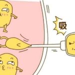 北京八大处尹博抽脂怎么样？擅长精细抽脂体型塑造/手法细腻、口碑好！