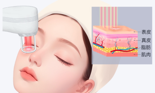 上海九院点阵激光医生推荐，在九院做点阵激光时，大家都爱约哪些医生