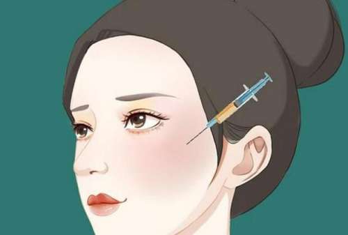 上海孙发明脂肪填充案例参考，技艺娴熟，手法专业