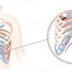 不想用假体隆鼻，还可以用什么？