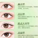 广州刘欢欢双眼皮价格贵吗？医生风格解析_含全新收费表