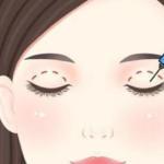 成都雷蕾双眼皮怎么样？初眼与修复技术详解+价格参考