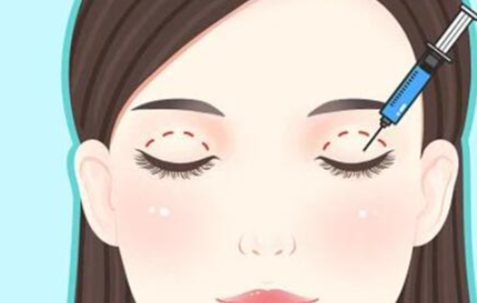 成都雷蕾双眼皮怎么样？初眼与修复技术详解+价格参考