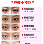 开眼角会让眼睛变大吗？开眼角手术是否真的能让眼睛变大