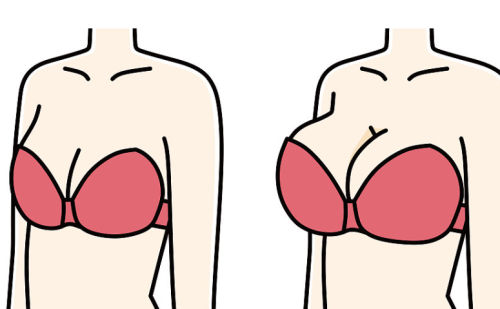 杨庆华隆胸价格是多少？根据假体类型、医院级别和个人方案划分价格段
