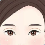 曾德浩双眼皮怎么样？解读曾德浩双眼皮技术细节、恢复过程与口碑反馈