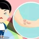 上海九院黄如林做疤痕怎么样？注射、激光、手术修复手段好