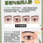 绵阳去眼袋外切技术医生排名：真实案例+数据揭秘，选对医生少走3年弯路