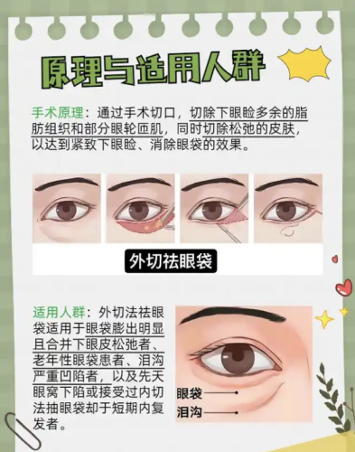 绵阳去眼袋外切技术医生排名：真实案例+数据揭秘，选对医生少走3年弯路