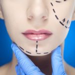 如何选择正规的拉皮除皱医院进行面部年轻化治疗