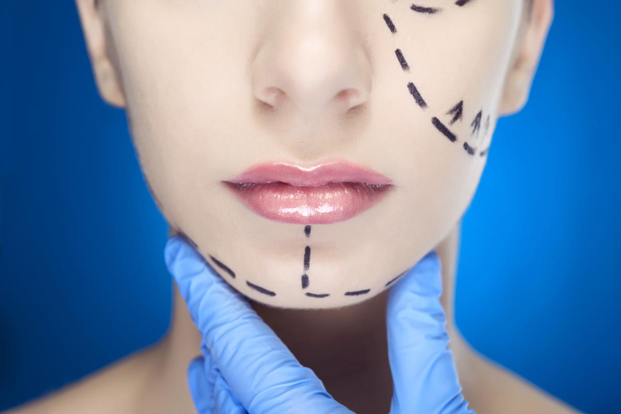 如何选择正规的拉皮除皱医院进行面部年轻化治疗