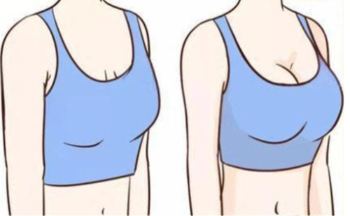 刘春军医生做隆胸怎么样？从术中技术细节到术后胸型稳定度全面分析