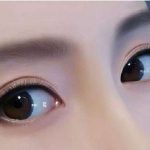 北京李燕双眼皮审美怎么样？自然审美路线，附技术分析