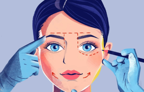 冀国杰医生眼综合案例夸张吗？案例风格和技术思路一篇讲清