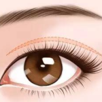 宁波郁琪华双眼皮案例展示！高清图集+价格参考，审美在线！