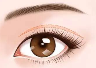 宁波郁琪华双眼皮案例展示！高清图集+价格参考，审美在线！