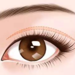 南京刘宁双眼皮怎么样？技术优势+价格参考，实力分析！