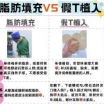 李俊明医生怎么样？胸部整形医生推荐 | 广州美莱