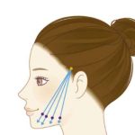 卢丙仑教授做拉皮手术价格是多少？技术实力与收费标准，附真实案例