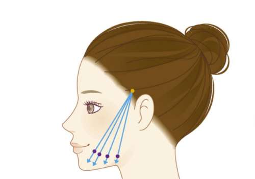 卢丙仑教授做拉皮手术价格是多少？技术实力与收费标准，附真实案例