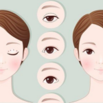 王淑杰做双眼皮怎么样？是否肿胀久、疤痕明显、效果自然度全盘点