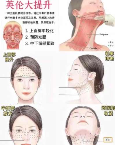 重庆英伦大提升打得好的医生_李亚栗、戴霞、朱星蓉等，价格\审美分析