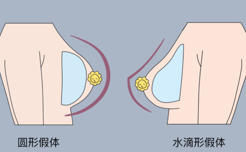 刘中策医生隆胸怎么样？从胸型塑造、上围曲线到疤痕隐蔽度全面评估