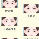 成都游晓波双眼皮案例分享！术后效果自然，价格9800元起