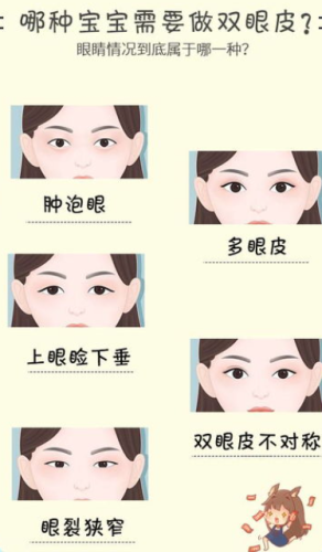 成都游晓波双眼皮案例分享！术后效果自然，价格9800元起