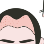 上海植发陈云锦 · 医生简介、擅长项目、收费价格一览