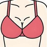 成都隆胸修复医生口碑比较好的有谁？蒲兴旺、王烈、陈杨内窥镜操作稳不稳