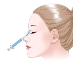 西安刘翔宇医生做鼻子怎么样？核心技术与审美解析，附真实案例参考