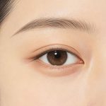 开眼角需要多久恢复自然？