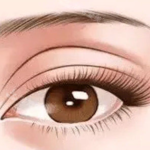 吴毅平做眼睛好不好？双眼皮、开眼角真实变化效果，看完再决定要不要做