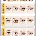 福州去眼袋好的医生：榜单公开，各有专长，按需 Pick