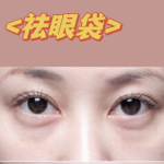 上海去眼袋哪个医生比较好？3位靠谱去眼袋医生实测，不同需求对应选