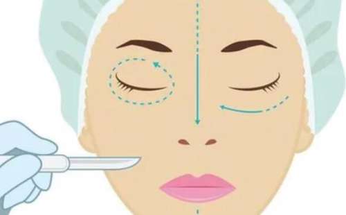 北京房嘉宾双眼皮修复怎么样？三甲背景医生技术_价格真相揭晓(眼修复必看)