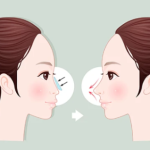 王先成做鼻子多少钱？收费区间、影响价格的关键因素全说明