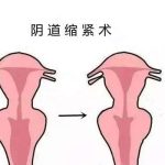 李峰永大夫技术怎么样？女性私密整形拿手_细节控、好评很多！