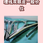 埋线法双眼皮价格一般多少钱？埋线法双眼皮手术费用及效果介绍