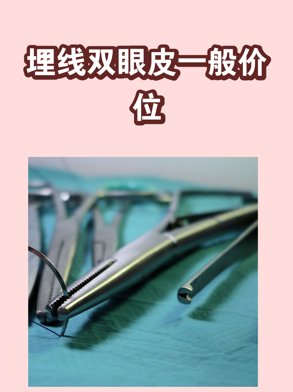 埋线法双眼皮价格一般多少钱？埋线法双眼皮手术费用及效果介绍