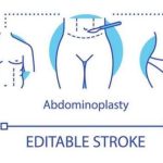 成都腹壁成形术做得好的医生：蒲小兵、张航等实力评估！附价格