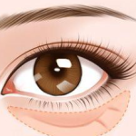 贾立平医生要预约吗？ 去眼袋专家，需要预约就诊，坐诊昆山市第一人民医院！