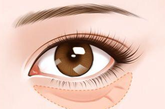 贾立平医生要预约吗？ 去眼袋专家，需要预约就诊，坐诊昆山市第一人民医院！