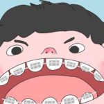 上海正畸钱玉芬案例分享+简介+收费标准