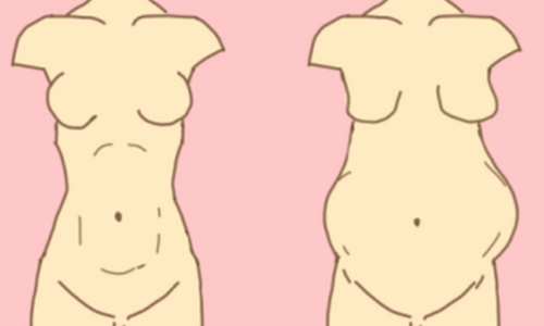 刘宾医生腹壁成形术全国排第几？从学术职称、手术量和业内评价来对比