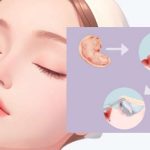 杭州吴溯帆医生做鼻综合好吗？老粉真实反馈：技术稳定、审美好！