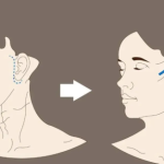 谢洋春做拉皮手术多少钱？价格区间、影响费用的几个关键因素一次说明