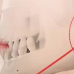 华西正颌医生有谁？能做正颌的专家名单和擅长方向都帮你整理好了