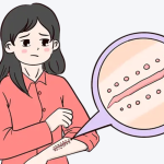 徐靖宏医生去疤痕的评价和口碑好吗？术后恢复体验、服务细节全面公开